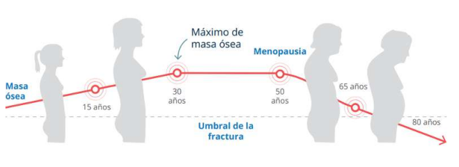 osteoporosis guía