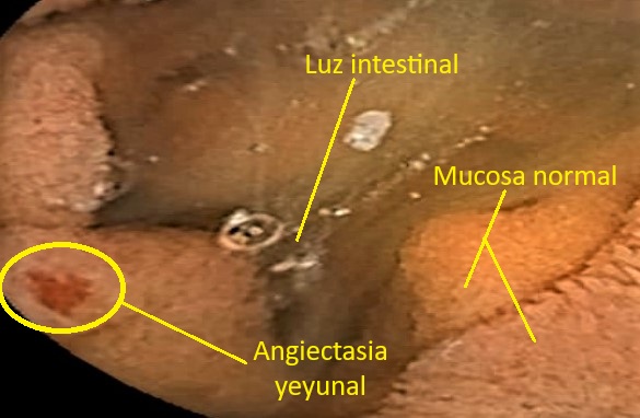 Tubo digestivo: yeyuno, íleon y colon.