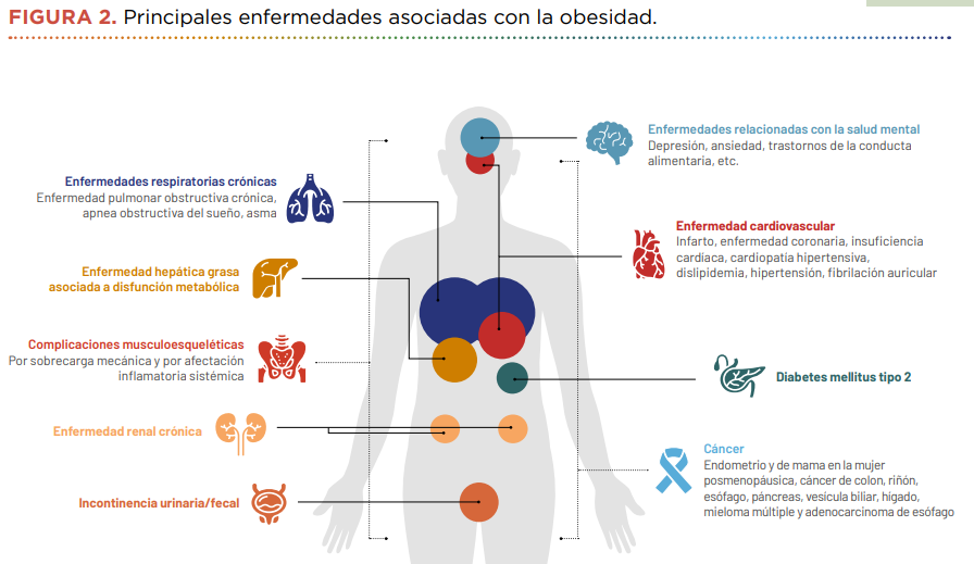 obesidad