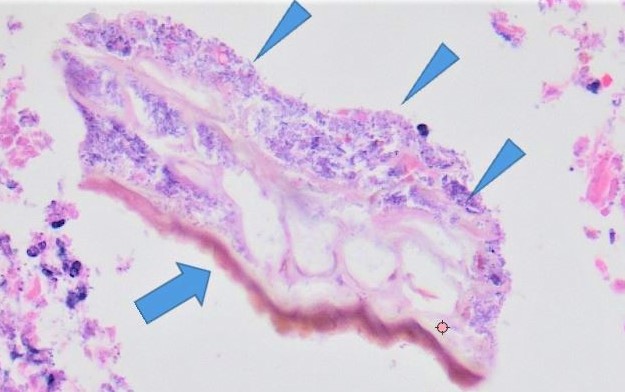 microbiota