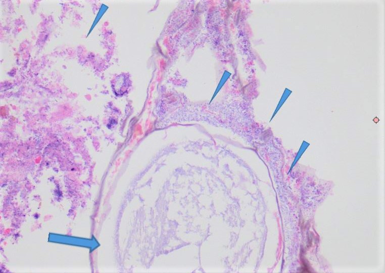 microbiota.