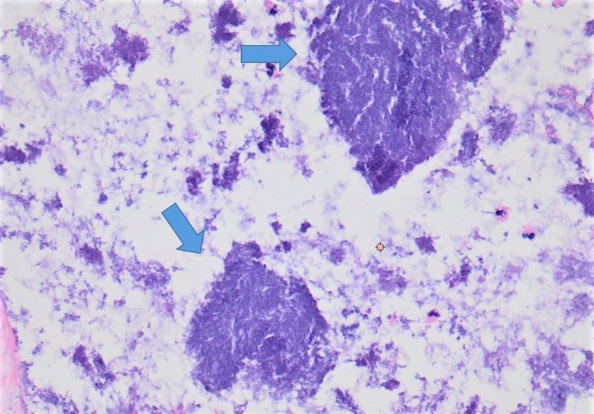 microbiota.