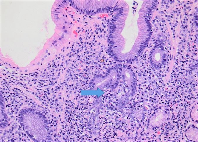 Bacteria patógena analizada en anatomopatología.