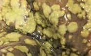 microbiota humana.