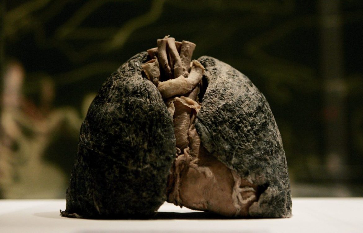 La falta de conocimiento del paciente retrasa el diagnóstico del cáncer de pulmón