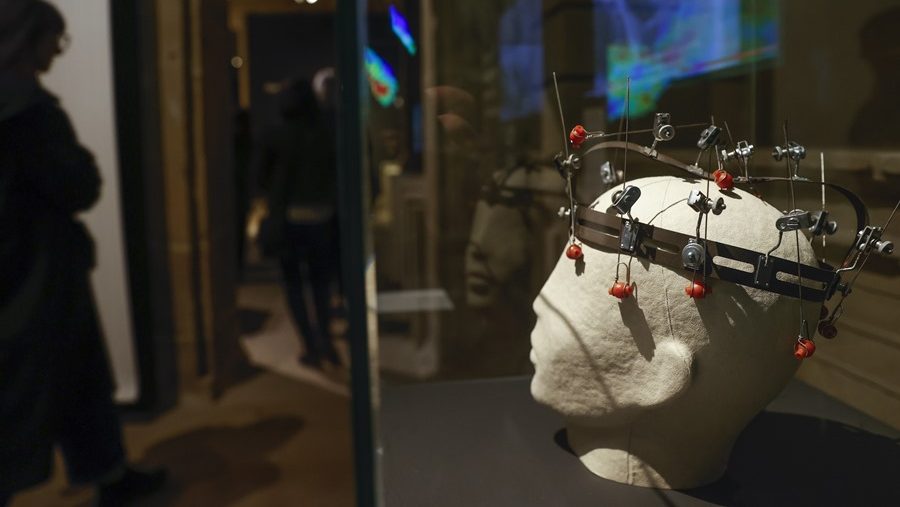 La inteligencia artificial, aún más útil en los tumores cerebrales infantiles