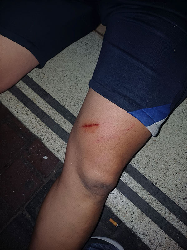 Protestas contra la megaminería en Mendoza: la policía provincial reprimió y detuvo manifestantes 2 Protestas contra la megaminería en Mendoza: la policía provincial reprimió y detuvo manifestantes